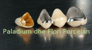 1384189655_femkeramia