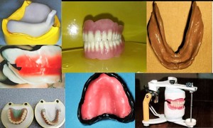 complete-denture-prosthodontics-step-by-step-9-638