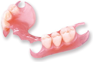 removable-partial-denture01