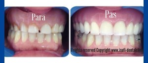 12719376_474213759443037_7966693260625066084_o